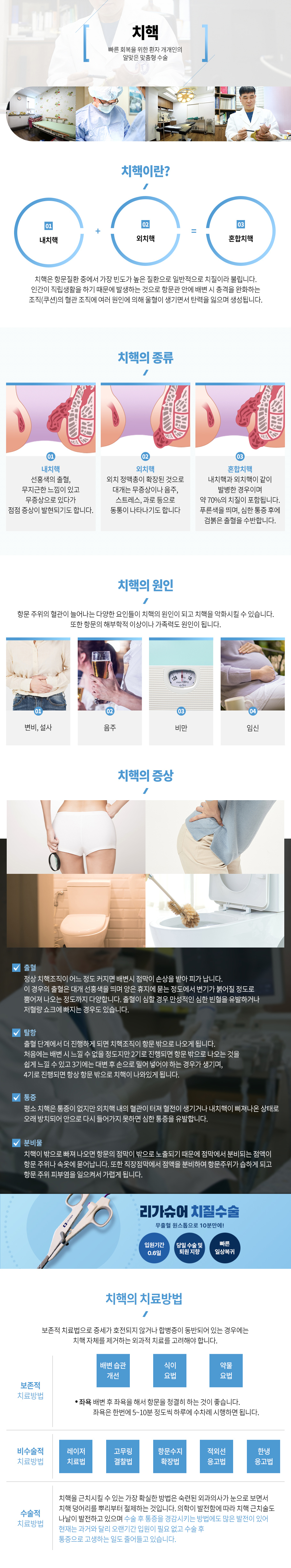 치핵