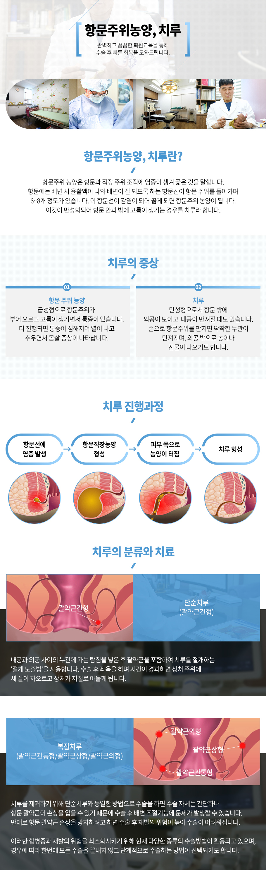 항문주위농양, 치루