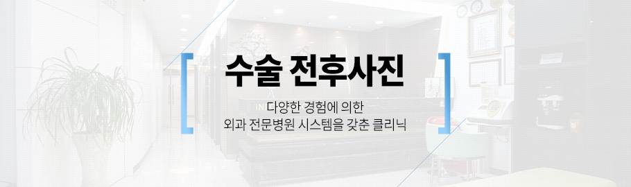 수술 전후사진
